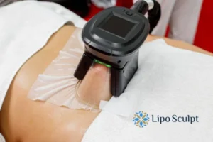 Cryolipolysis Helping You Getting that Perfect Summer Body 3 Cryolipolysis Barr Common can give you the best summer body - contact us today!