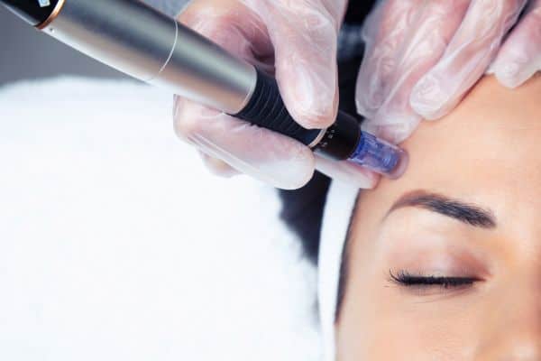 Explaining Total Skin Tightening Treatment and What to Expect 2 What Skin Concerns Can Total Skin Tightening Treatment Help With Barr Common?